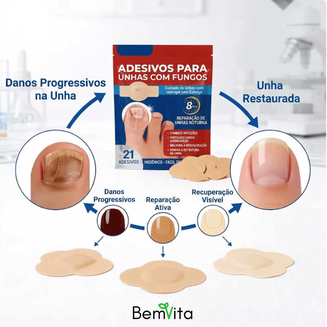 VitaUnha™ - Adesivos Tratamento para Fungos e Micose nas Unhas