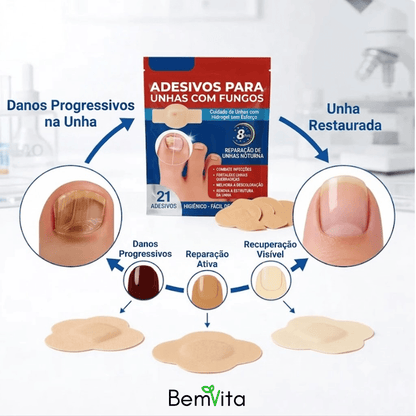 VitaUnha™ - Adesivos Tratamento para Fungos e Micose nas Unhas