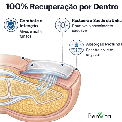VitaUnha™ - Adesivos Tratamento para Fungos e Micose nas Unhas