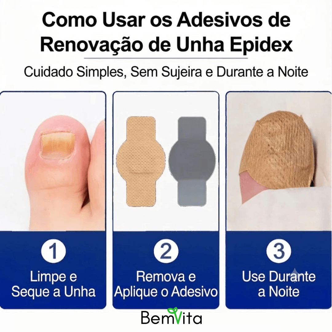 VitaUnha™ - Adesivos Tratamento para Fungos e Micose nas Unhas