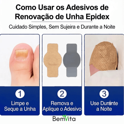 VitaUnha™ - Adesivos Tratamento para Fungos e Micose nas Unhas